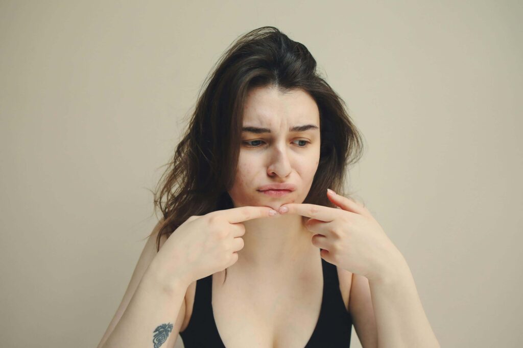 ingrown hairs
